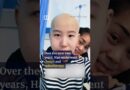 Chinese cancer survivor inspires through dance