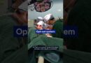 Why there is such a great shortage of organ donors in Germany | DW News