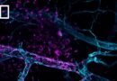 China’s novel super microscope shows how electroacupuncture calms cell chaos