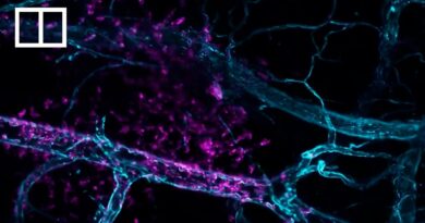 China’s novel super microscope shows how electroacupuncture calms cell chaos