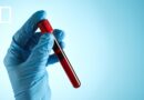 Hong Kong develops simpler, cheaper and more accurate way to detect cancer