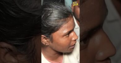 ‘लाइट कट कर के मारा, मीडिया को मारा है’ Jharkhand Police की लाठीचार्ज की शिकार बच्ची ने क्या कहा?
