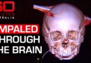How an 18-year-old survived a steel pole through his head | 60 Minutes Australia