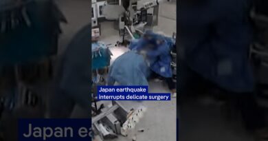 Japan earthquake interrupts delicate surgery | DW News