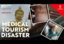 Tracking down a notorious cosmetic surgeon in Thailand | Extra Minutes