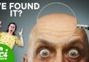 What Baldness and Cancer Might Have in Common