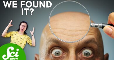 What Baldness and Cancer Might Have in Common