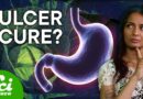 The Cure for Ulcers Is … Cabbage