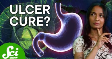 The Cure for Ulcers Is … Cabbage