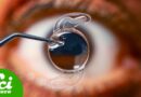 The Plane Crash That Gave Us Cataract Surgery