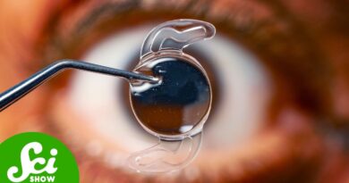 The Plane Crash That Gave Us Cataract Surgery